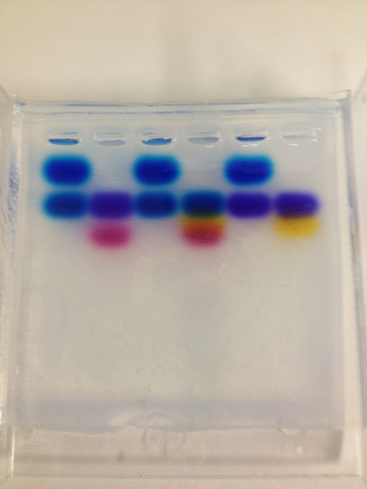 electrophoresis results